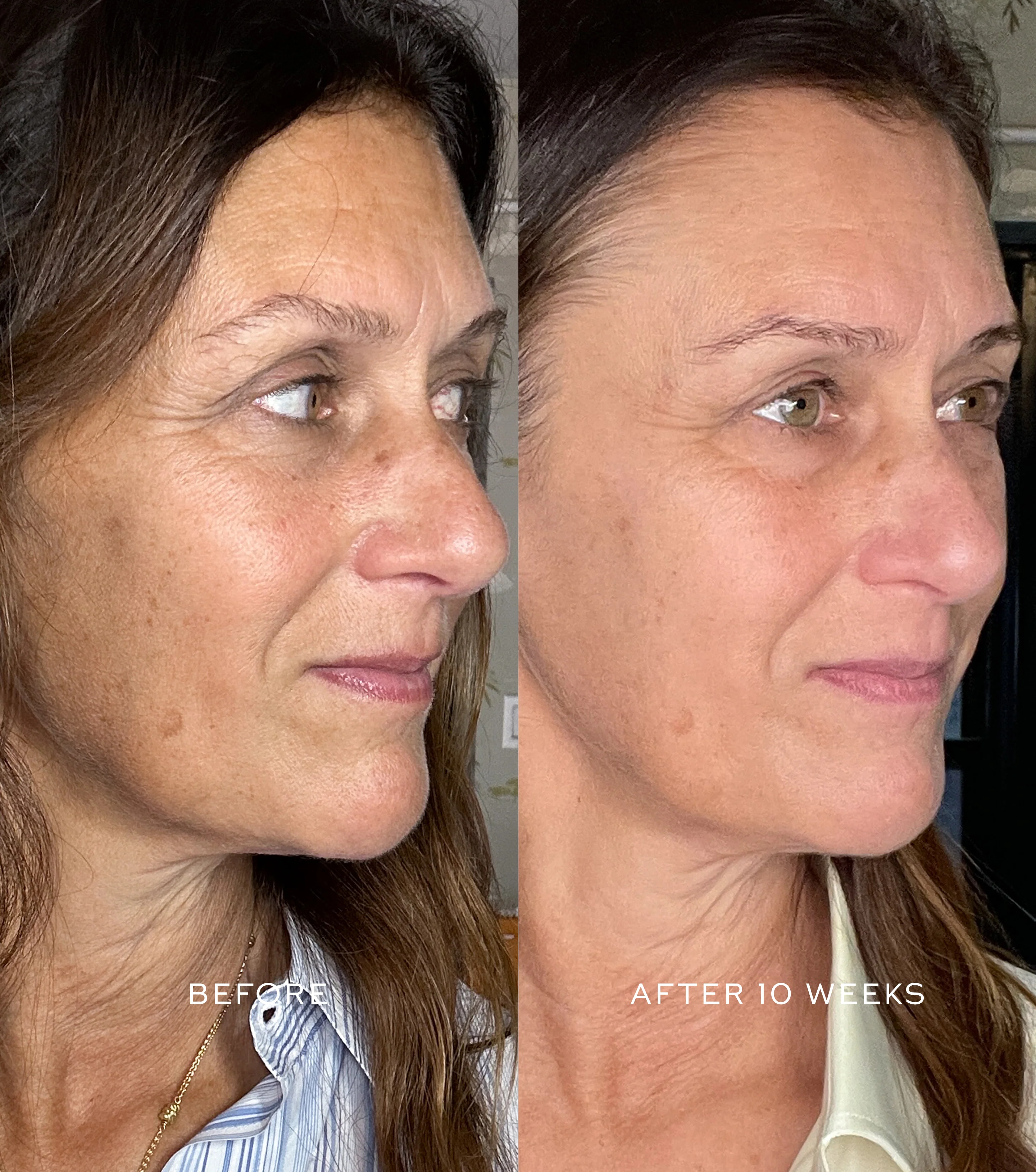 Suprême C Serum - Image 3