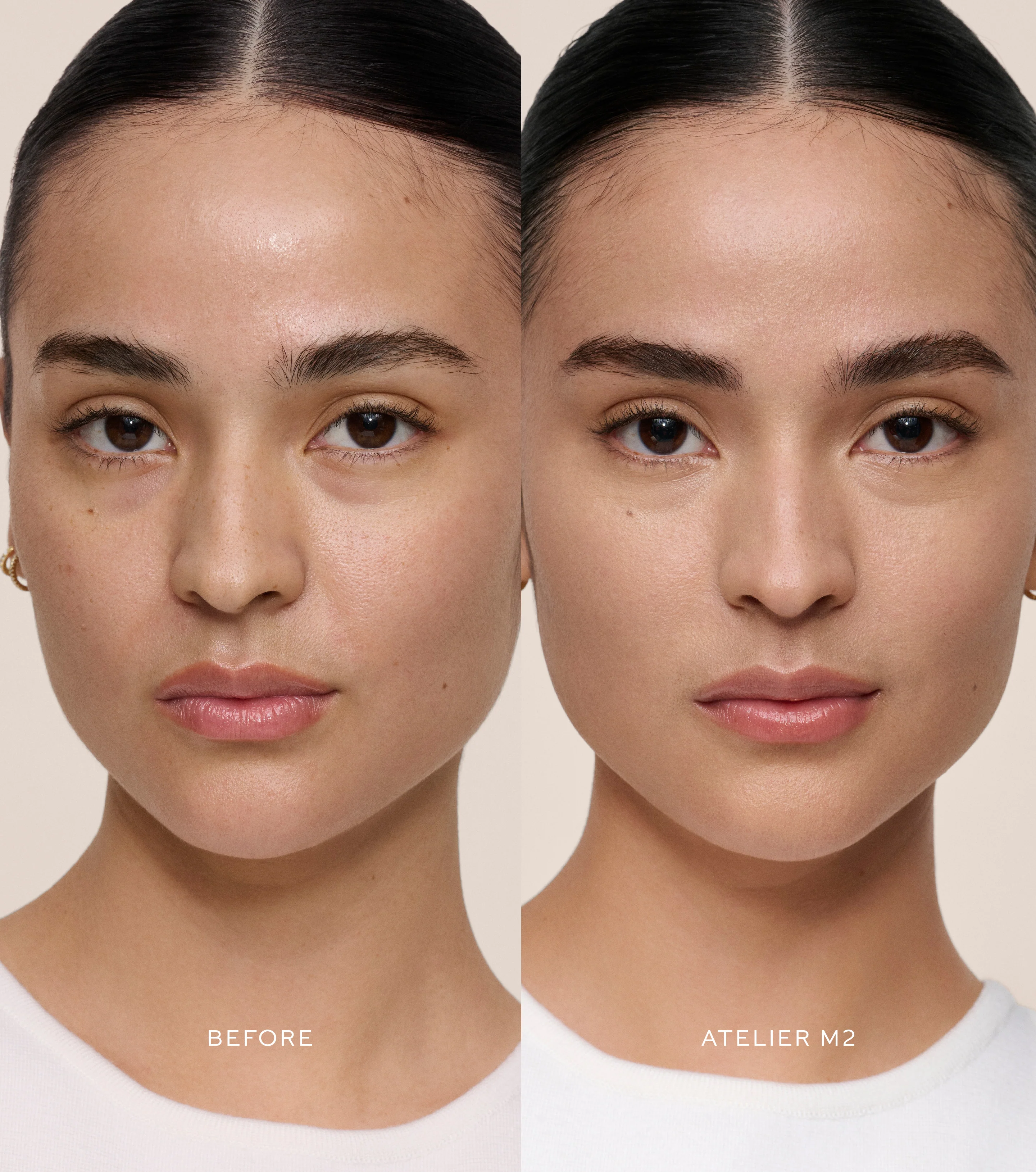 Vital Skincare Concealer - Atelier M2 - Image 3